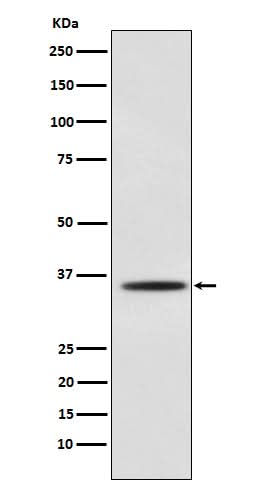 Anti-Myogenin Monoclonal Antibody Boster Bio