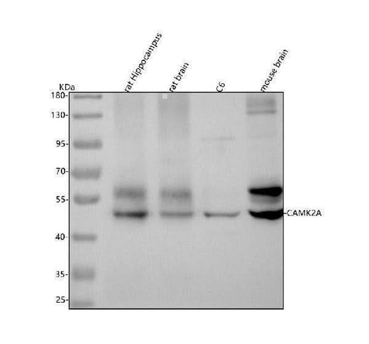 Anti-CaMKII alpha CAMK2A Rabbit Monoclonal Antibody Boster Bio