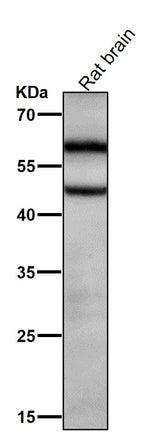 Anti-Phospho-CaMKII alpha (T286) Rabbit Monoclonal Antibody Boster Bio