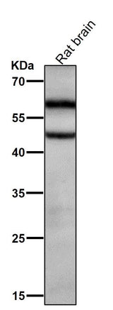 Anti-Phospho-CaMKII alpha (T286) Rabbit Monoclonal Antibody Boster Bio