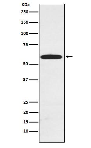 Anti-RAD23A Rabbit Monoclonal Antibody Boster Bio