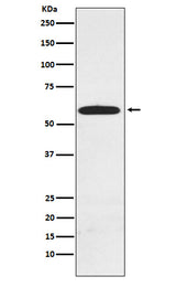 Anti-RAD23A Rabbit Monoclonal Antibody Boster Bio