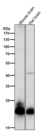 Anti-RAC3 Rabbit Monoclonal Antibody Boster Bio