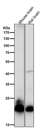 Anti-RAC3 Rabbit Monoclonal Antibody Boster Bio
