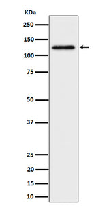 Anti-SPINK5 / LEKTI Rabbit Monoclonal Antibody Boster Bio