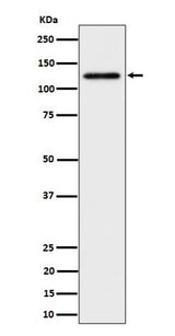 Anti-SPINK5 / LEKTI Rabbit Monoclonal Antibody Boster Bio