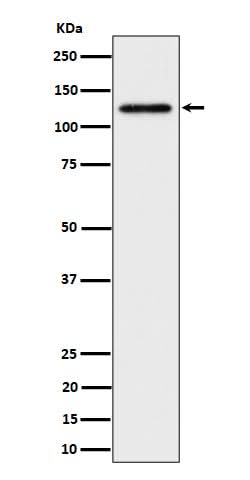 Anti-SPINK5 / LEKTI Rabbit Monoclonal Antibody Boster Bio