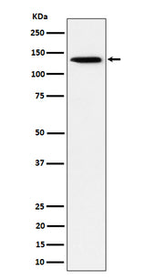 Anti-TRIM24 Rabbit Monoclonal Antibody Boster Bio