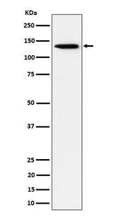 Anti-TRIM24 Rabbit Monoclonal Antibody Boster Bio