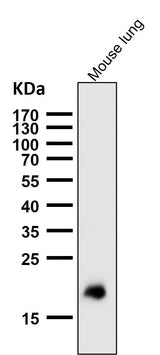 Anti-Claudin 5 CLDN5 Rabbit Monoclonal Antibody Boster Bio