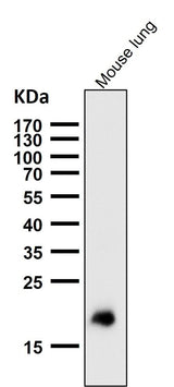 Anti-Claudin 5 CLDN5 Rabbit Monoclonal Antibody Boster Bio