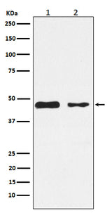 Anti-PDK2 Monoclonal Antibody Boster Bio