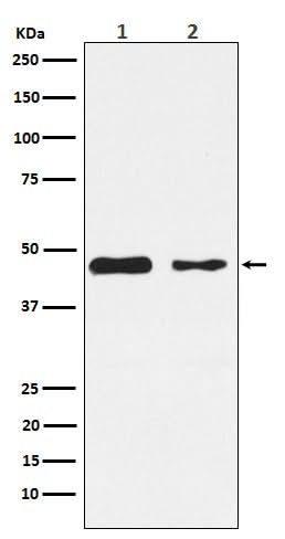 Anti-PDK2 Monoclonal Antibody Boster Bio