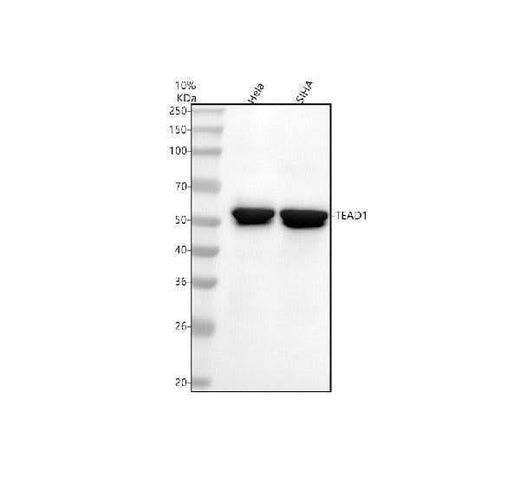 Anti-TEAD1 Rabbit Monoclonal Antibody Boster Bio