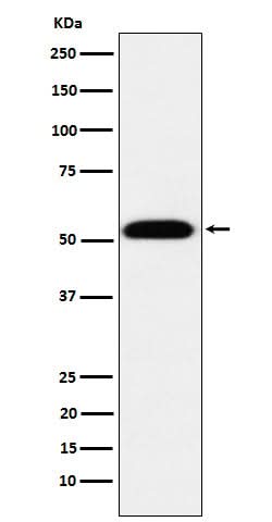 Anti-TEAD1 Rabbit Monoclonal Antibody Boster Bio