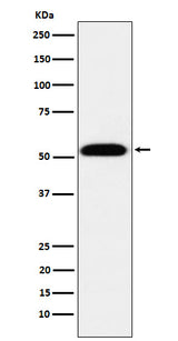 Anti-TEAD1 Rabbit Monoclonal Antibody Boster Bio