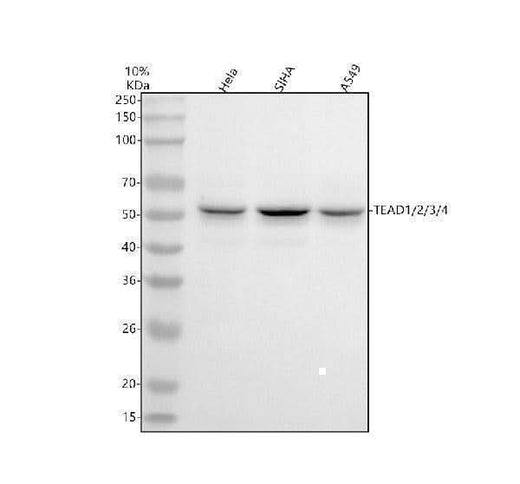 Anti-TEAD1/2/3/4 Rabbit Monoclonal Antibody Boster Bio