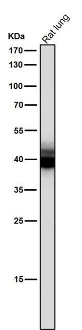 Anti-Mesothelin Monoclonal Antibody Boster Bio