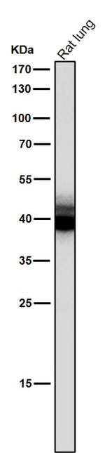 Anti-Mesothelin Monoclonal Antibody Boster Bio