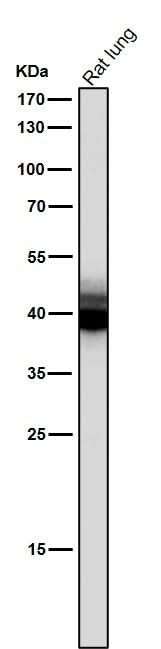 Anti-Mesothelin Monoclonal Antibody Boster Bio