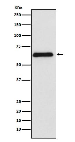 Anti-PARP2 Rabbit Monoclonal Antibody Boster Bio