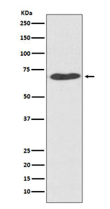 Anti-PDI PDIA2 Rabbit Monoclonal Antibody Boster Bio