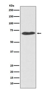Anti-PDI PDIA2 Rabbit Monoclonal Antibody Boster Bio