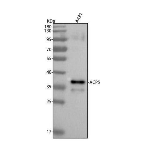 Anti-TRAP ACP5 Monoclonal Antibody Boster Bio