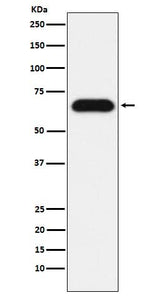 Anti-Nucleostemin Rabbit Monoclonal Antibody Boster Bio