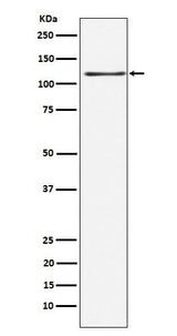 Anti-KSR1 Rabbit Monoclonal Antibody Boster Bio
