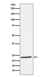 Anti-IL32 Rabbit Monoclonal Antibody Boster Bio