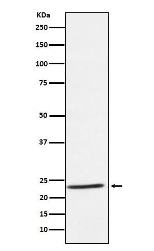 Anti-IL32 Rabbit Monoclonal Antibody Boster Bio