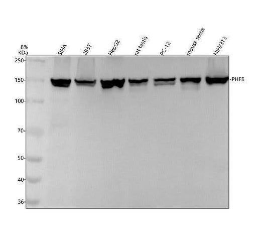 Anti-PHF8 Monoclonal Antibody Boster Bio