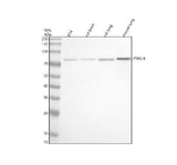 Anti-PKC eta Rabbit Monoclonal Antibody Boster Bio