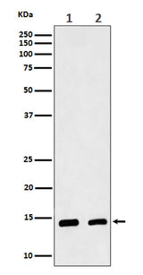 Anti-CRABP2 Rabbit Monoclonal Antibody Boster Bio