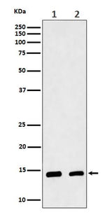 Anti-CRABP2 Rabbit Monoclonal Antibody Boster Bio