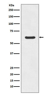 Anti-ASNS/Asparagine Synthetase Rabbit Monoclonal Antibody Boster Bio