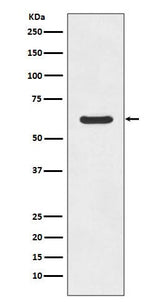 Anti-ASNS/Asparagine Synthetase Rabbit Monoclonal Antibody Boster Bio