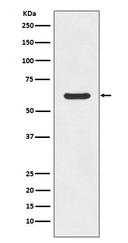 Anti-ASNS/Asparagine Synthetase Rabbit Monoclonal Antibody Boster Bio
