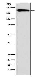 Anti-SMARCC1/BAF155 Rabbit Monoclonal Antibody Boster Bio