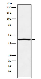 Anti-HOXA13 Rabbit Monoclonal Antibody Boster Bio