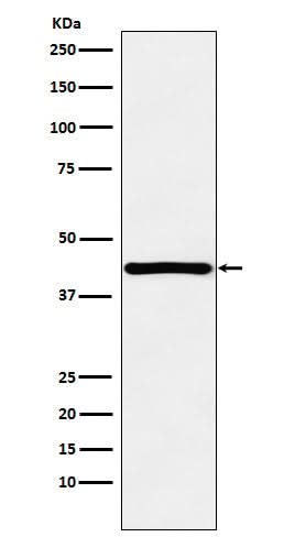 Anti-HOXA13 Rabbit Monoclonal Antibody Boster Bio