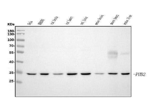 Anti-REA/PHB2 Antibody Picoband® (monoclonal, 2B5 Boster Bio