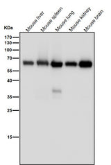 Anti-Monoamine Oxidase A Rabbit Monoclonal Antibody Boster Bio