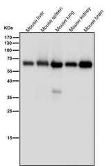 Anti-Monoamine Oxidase A Rabbit Monoclonal Antibody Boster Bio