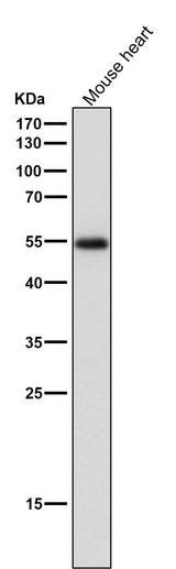 Anti-ERR alpha Rabbit Monoclonal Antibody Boster Bio