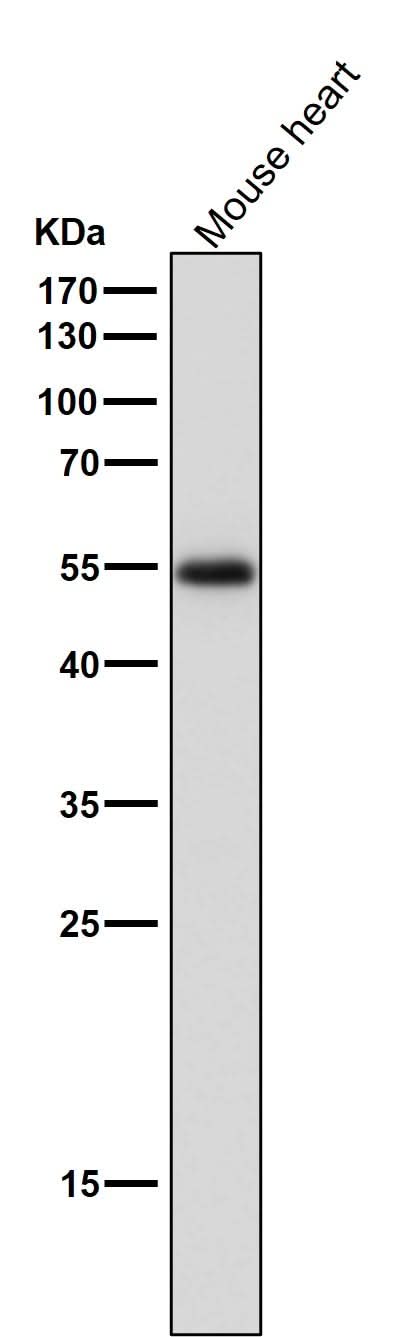 Anti-ERR alpha Rabbit Monoclonal Antibody Boster Bio