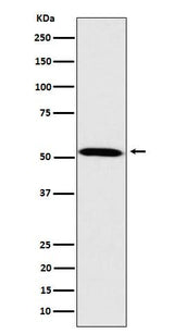 Anti-Fukutin Rabbit Monoclonal Antibody Boster Bio