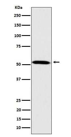 Anti-Fukutin Rabbit Monoclonal Antibody Boster Bio