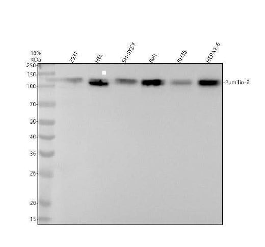 Anti-Pumilio 2 Rabbit Monoclonal Antibody Boster Bio